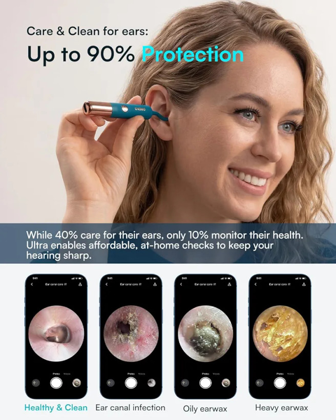 گوش پاک دوربین دار (5G Wi-Fi chip) برند Bebird مدل EarSight Ultra